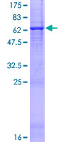 OGFOD3 Protein - 12.5% SDS-PAGE of human FLJ22222 stained with Coomassie Blue