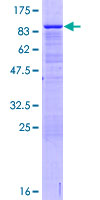 OGFRL1 Protein - 12.5% SDS-PAGE of human OGFRL1 stained with Coomassie Blue