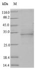 OGG1 Protein - (Tris-Glycine gel) Discontinuous SDS-PAGE (reduced) with 5% enrichment gel and 15% separation gel.