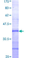 OGG1 Protein - 12.5% SDS-PAGE Stained with Coomassie Blue