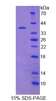 OGG1 Protein - Recombinant Oxoguanine Glycosylase 1 By SDS-PAGE