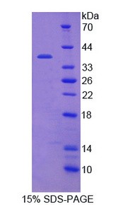 OGG1 Protein - Recombinant Oxoguanine Glycosylase 1 By SDS-PAGE