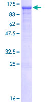 OGT / O-GLCNAC Protein - 12.5% SDS-PAGE of human OGT stained with Coomassie Blue