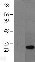 OIP5 Protein - Western validation with an anti-DDK antibody * L: Control HEK293 lysate R: Over-expression lysate
