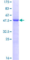 OIP5 Protein - 12.5% SDS-PAGE of human OIP5 stained with Coomassie Blue