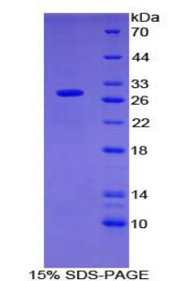 OIT3 Protein - Recombinant Oncoprotein Induced Transcript 3 By SDS-PAGE