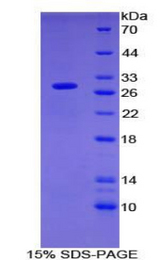 OIT3 Protein - Recombinant Oncoprotein Induced Transcript 3 By SDS-PAGE