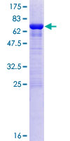 OLA1 Protein - 12.5% SDS-PAGE of human OLA1 stained with Coomassie Blue