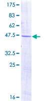 OLFM1 Protein - 12.5% SDS-PAGE of human OLFM1 stained with Coomassie Blue