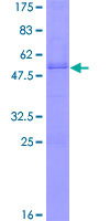 OLIG1 Protein - 12.5% SDS-PAGE of human OLIG1 stained with Coomassie Blue