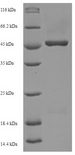 OLIG2 Protein - (Tris-Glycine gel) Discontinuous SDS-PAGE (reduced) with 5% enrichment gel and 15% separation gel.