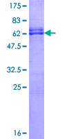 OLIG2 Protein - 12.5% SDS-PAGE of human OLIG2 stained with Coomassie Blue