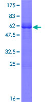 OLIG3 Protein - 12.5% SDS-PAGE of human OLIG3 stained with Coomassie Blue