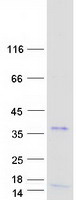 OLIG3 Protein - Purified recombinant protein OLIG3 was analyzed by SDS-PAGE gel and Coomassie Blue Staining
