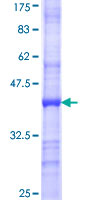 OMD / Osteomodulin Protein - 12.5% SDS-PAGE Stained with Coomassie Blue