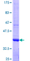 OMP Protein - 12.5% SDS-PAGE Stained with Coomassie Blue.