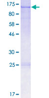 OPA1 Protein - 12.5% SDS-PAGE of human OPA1 stained with Coomassie Blue