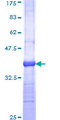 OPA1 Protein - 12.5% SDS-PAGE Stained with Coomassie Blue.