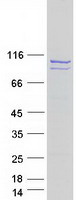OPA1 Protein - Purified recombinant protein OPA1 was analyzed by SDS-PAGE gel and Coomassie Blue Staining