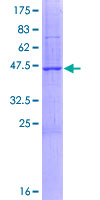 OPA3 Protein - 12.5% SDS-PAGE of human OPA3 stained with Coomassie Blue