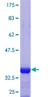 OPA3 Protein - 12.5% SDS-PAGE Stained with Coomassie Blue.
