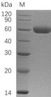 OPG / Osteoprotegerin Protein - (Tris-Glycine gel) Discontinuous SDS-PAGE (reduced) with 5% enrichment gel and 15% separation gel.