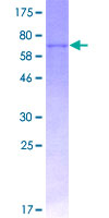 OPG / Osteoprotegerin Protein - 12.5% SDS-PAGE of human TNFRSF11B stained with Coomassie Blue