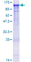 OPHN1 Protein - 12.5% SDS-PAGE of human OPHN1 stained with Coomassie Blue