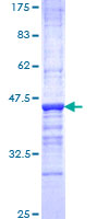 OPHN1 Protein - 12.5% SDS-PAGE Stained with Coomassie Blue.