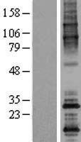 OPPO1 / ODF4 Protein - Western validation with an anti-DDK antibody * L: Control HEK293 lysate R: Over-expression lysate