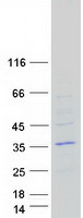 OPPO1 / ODF4 Protein - Purified recombinant protein ODF4 was analyzed by SDS-PAGE gel and Coomassie Blue Staining