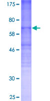 OPRM1 / Mu Opioid Receptor Protein - 12.5% SDS-PAGE of human OPRM1 stained with Coomassie Blue