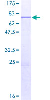 OPTIMEDIN / OLFM3 Protein - 12.5% SDS-PAGE of human OLFM3 stained with Coomassie Blue