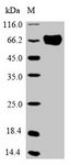OPTN / Optineurin Protein - (Tris-Glycine gel) Discontinuous SDS-PAGE (reduced) with 5% enrichment gel and 15% separation gel.