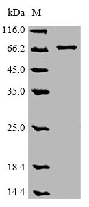 OPTN / Optineurin Protein - (Tris-Glycine gel) Discontinuous SDS-PAGE (reduced) with 5% enrichment gel and 15% separation gel.