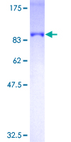OPTN / Optineurin Protein - 12.5% SDS-PAGE of human OPTN stained with Coomassie Blue