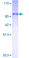 OPTN / Optineurin Protein - 12.5% SDS-PAGE of human OPTN stained with Coomassie Blue