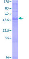 OR10AD1 Protein - 12.5% SDS-PAGE of human OR10AD1 stained with Coomassie Blue