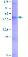 OR10G3 Protein - 12.5% SDS-PAGE of human OR10G3 stained with Coomassie Blue