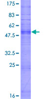 OR10G8 Protein - 12.5% SDS-PAGE of human OR10G8 stained with Coomassie Blue