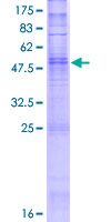 OR10K2 Protein - 12.5% SDS-PAGE of human OR10K2 stained with Coomassie Blue
