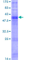 OR11A1 Protein - 12.5% SDS-PAGE of human OR11A1 stained with Coomassie Blue