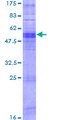OR11A1 Protein - 12.5% SDS-PAGE of human OR11A1 stained with Coomassie Blue
