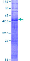 OR11G2 Protein - 12.5% SDS-PAGE of human OR11G2 stained with Coomassie Blue