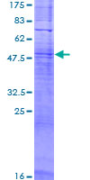 OR11L1 Protein - 12.5% SDS-PAGE of human OR11L1 stained with Coomassie Blue