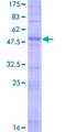 OR12D2 Protein - 12.5% SDS-PAGE of human OR12D2 stained with Coomassie Blue
