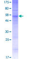 OR13C4 / OR2K1 Protein - 12.5% SDS-PAGE of human OR13C4 stained with Coomassie Blue