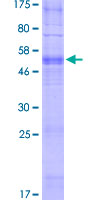 OR14A16 Protein - 12.5% SDS-PAGE of human OR14A16 stained with Coomassie Blue