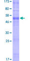 OR14A16 Protein - 12.5% SDS-PAGE of human OR14A16 stained with Coomassie Blue