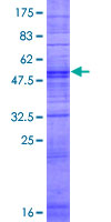 OR14C36 / OR5BF1 Protein - 12.5% SDS-PAGE of human OR5BF1 stained with Coomassie Blue